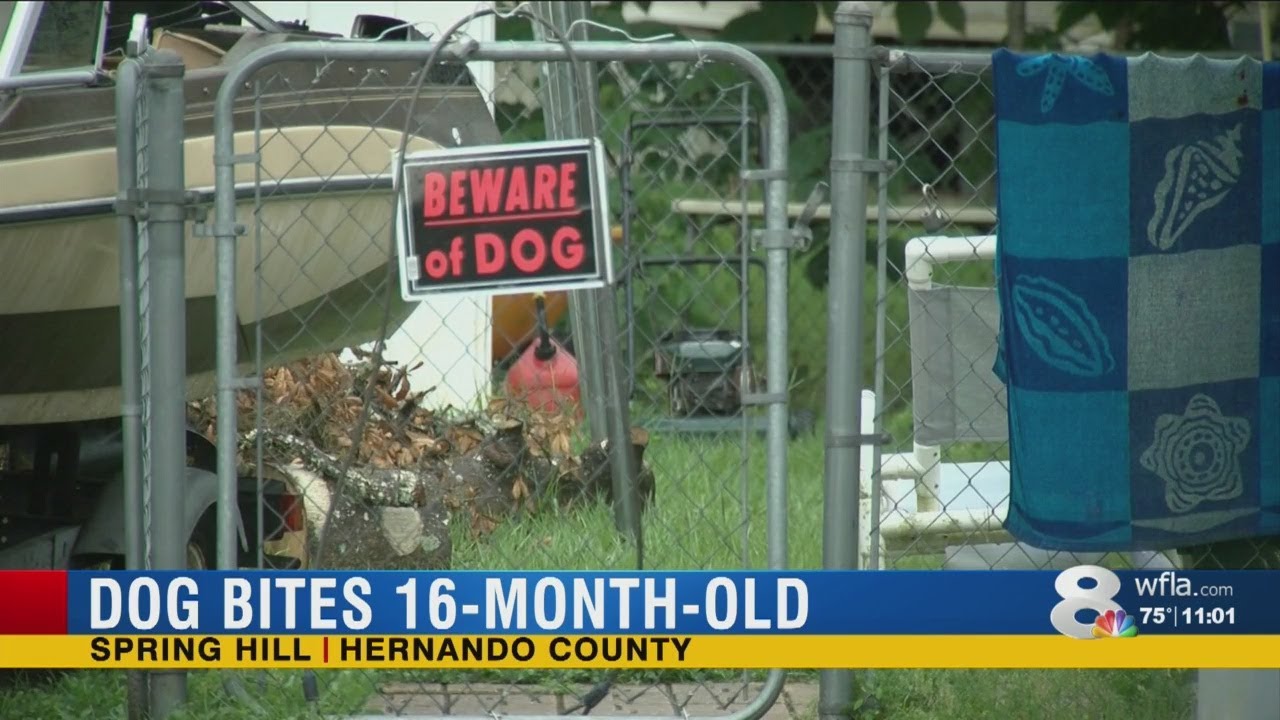 Family dog attacks 16-month-old
