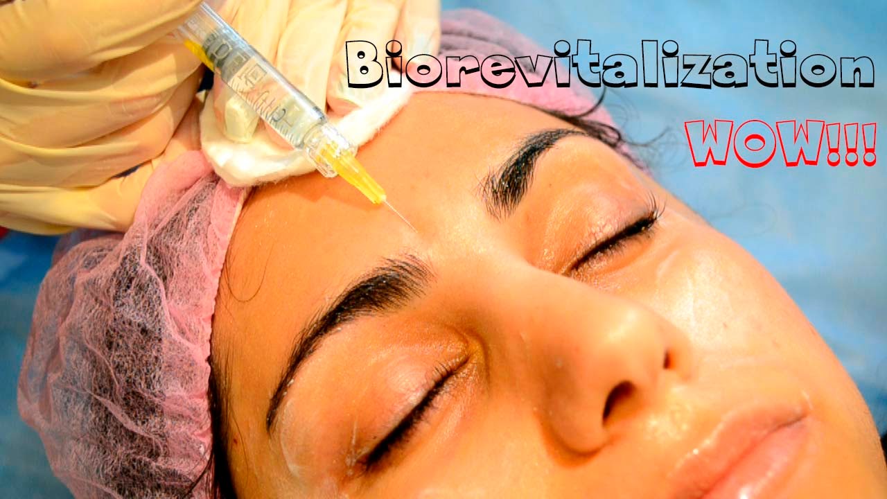 Биоревитализация пошагово // Как сохранить молодость кожи? // Beauty with Dianatadi