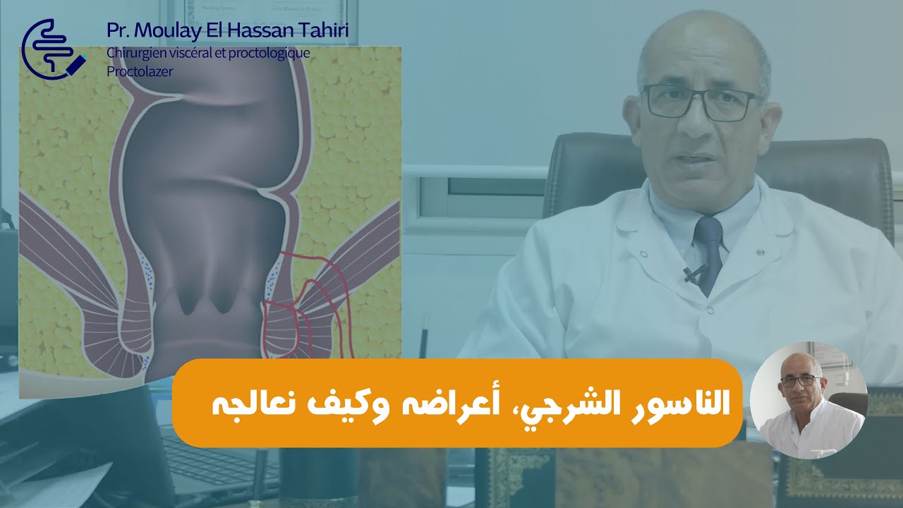 ماهو الناسور الشرجي، ماهي أعراضه وكيف نعالجه مع البروفيسور مولاي الحسن طاهري