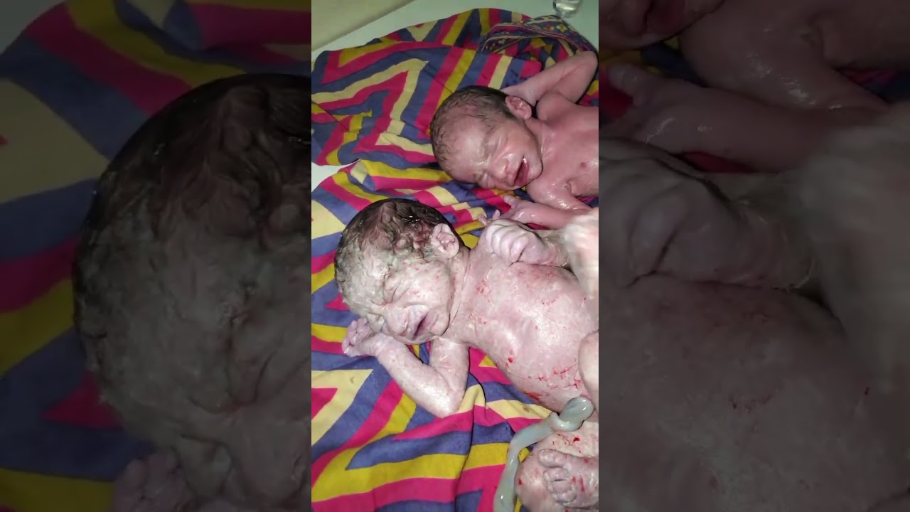Two newborn babies were born to mother at same time.You can see Shinny vernix and crying in video