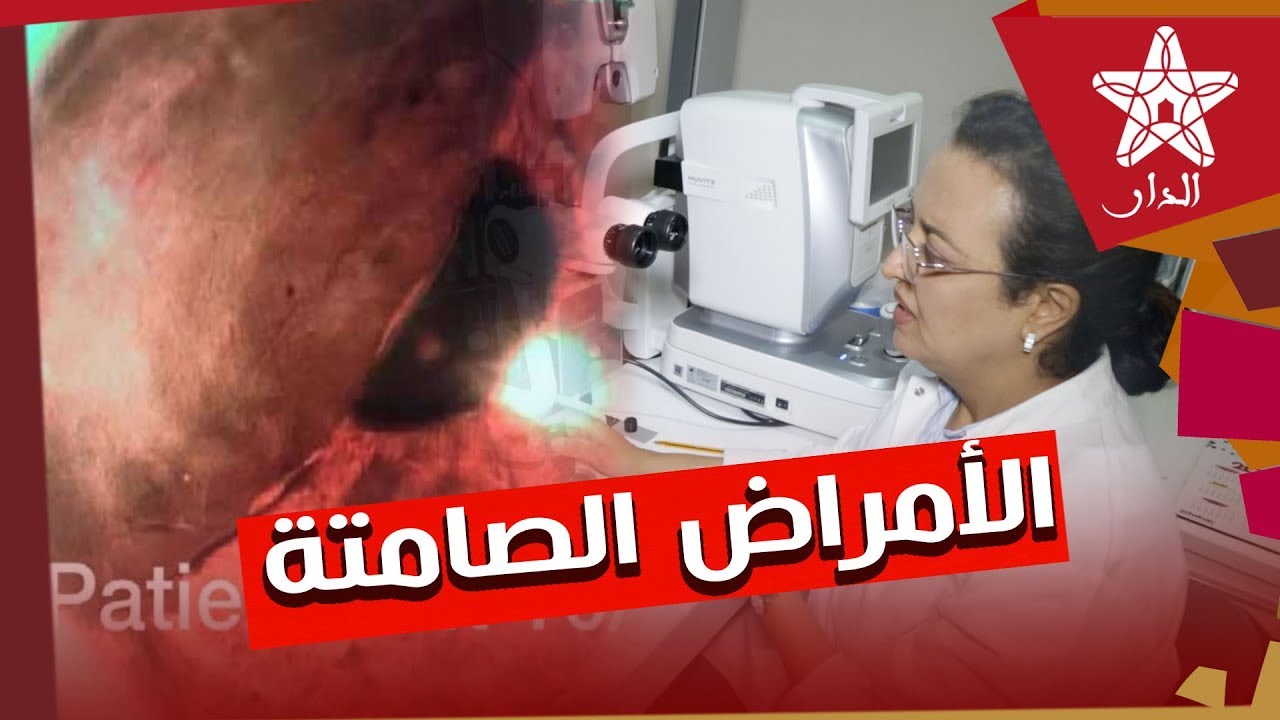 اختصاصية في طب العيون تكشف عن أمراض خطيرة تهدد سلامة المواطنين يصعب تشخيصها بجهاز قياس البصر