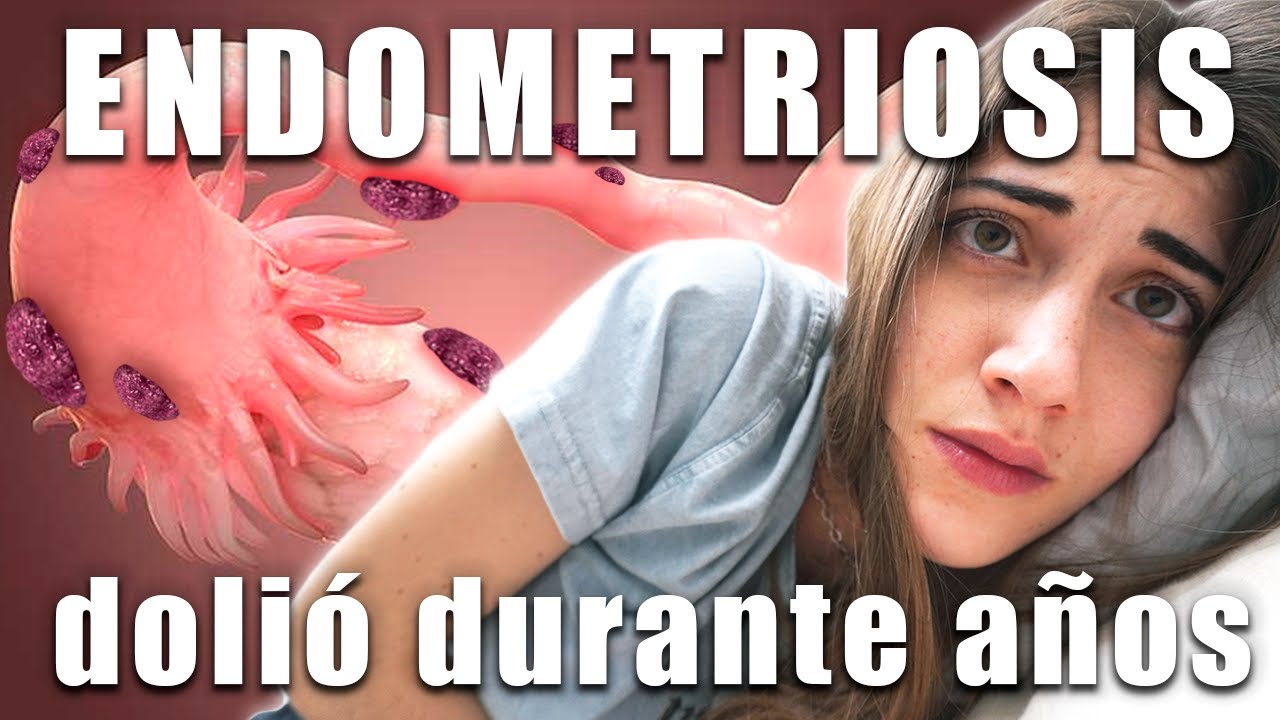 ENDOMETRIOSIS: TODO lo que aprendí sobre una enfermedad OLVIDADA (y dolorosa)
