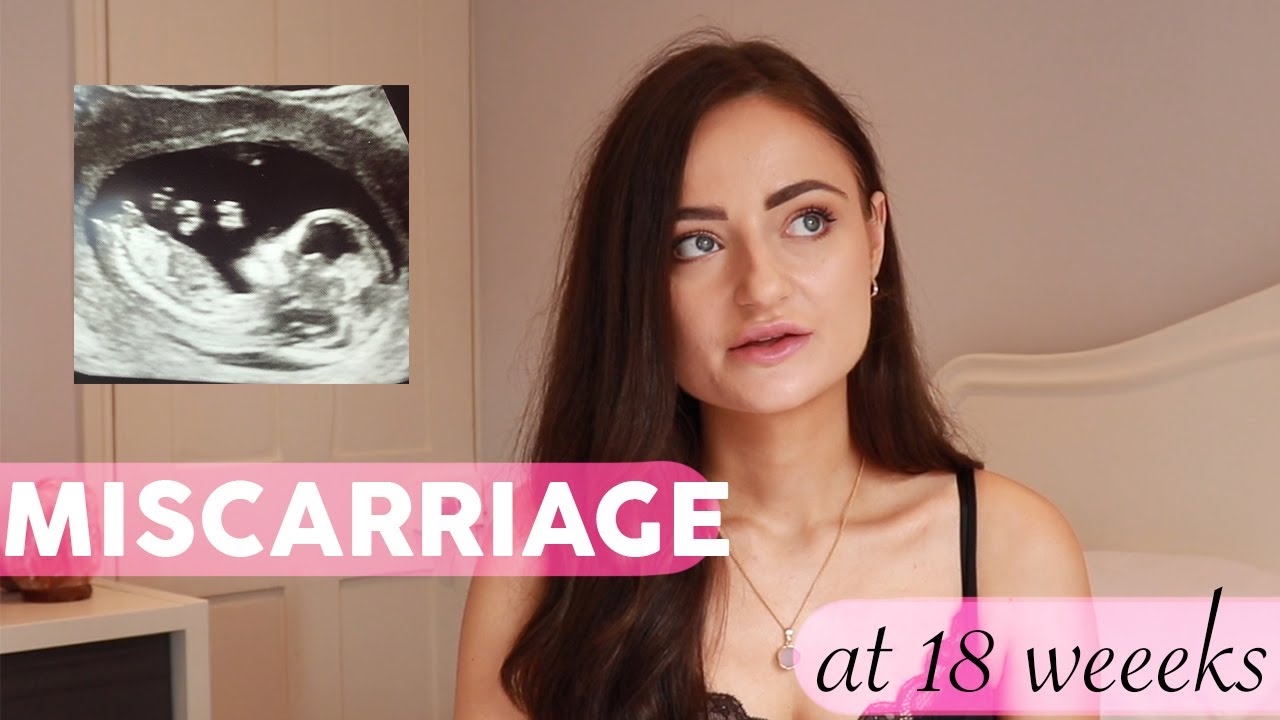My Miscarriage at 18 Weeks | Low Amniotic Fluid, Low Papp-A & Small Baby