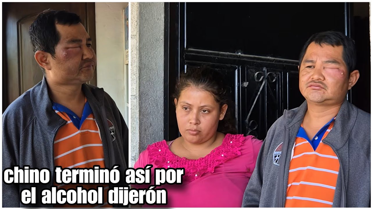 Mira lo que le pasó a chino por tanto alcohol podria perder la vista