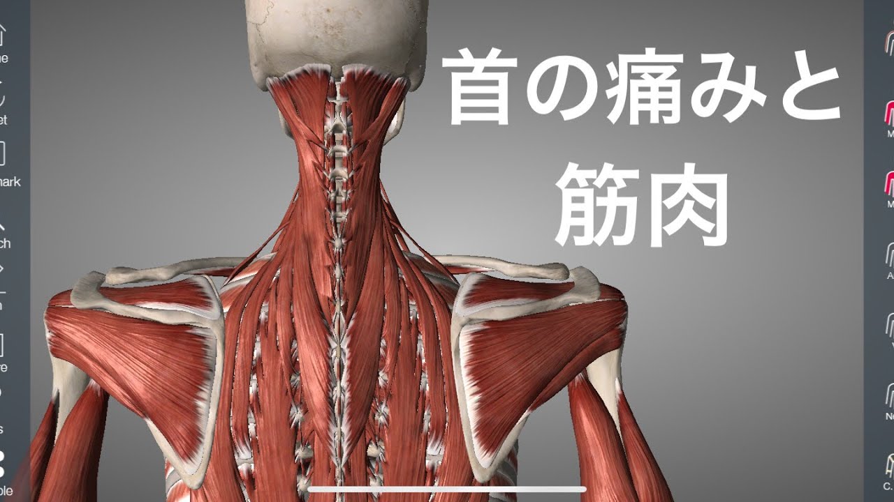 首の痛みに関わる筋肉と靭帯を解説してみた