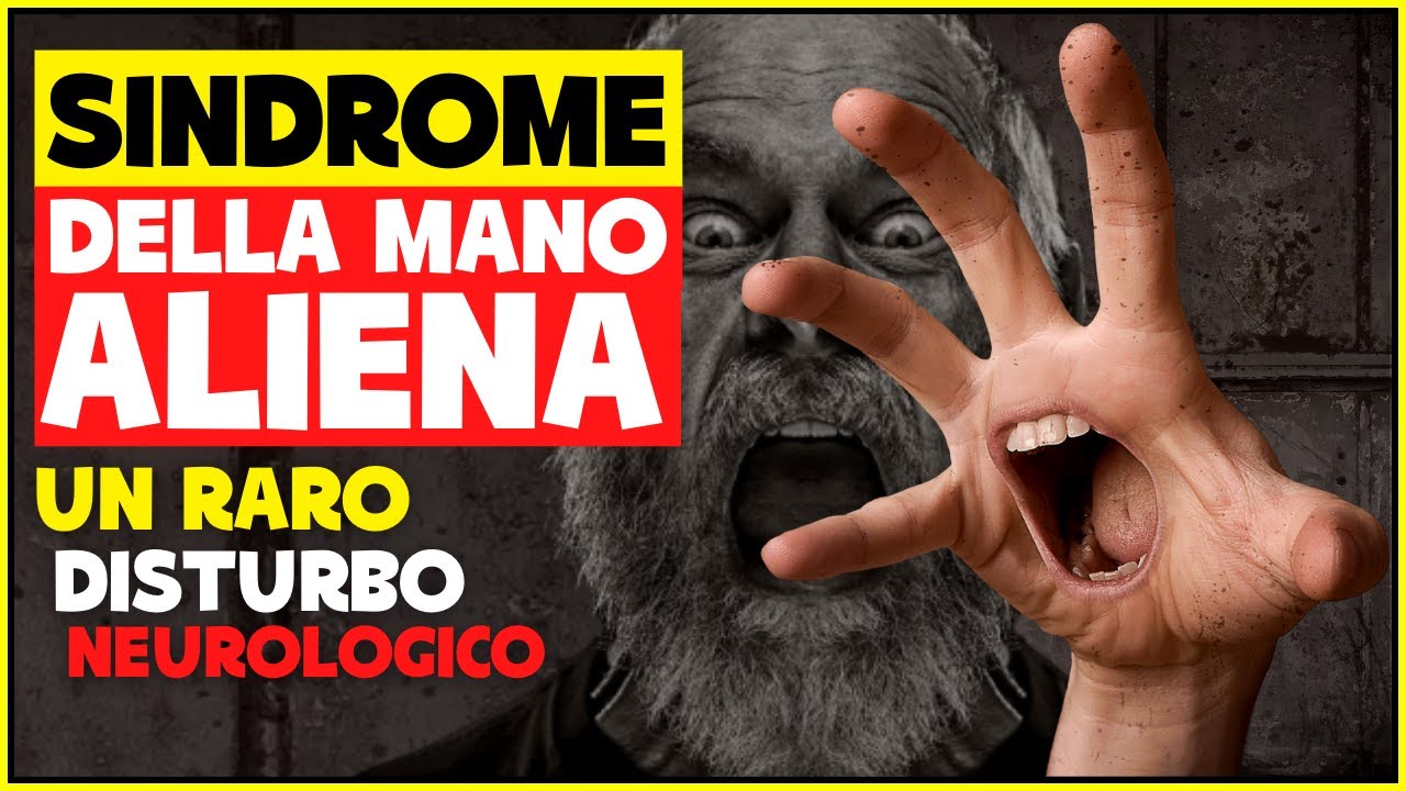 Sindrome Della Mano Aliena: cos'&egrave;? Sintomi, Cause e Cura | Malattie Pi&ugrave; Strane e Rare Al Mondo