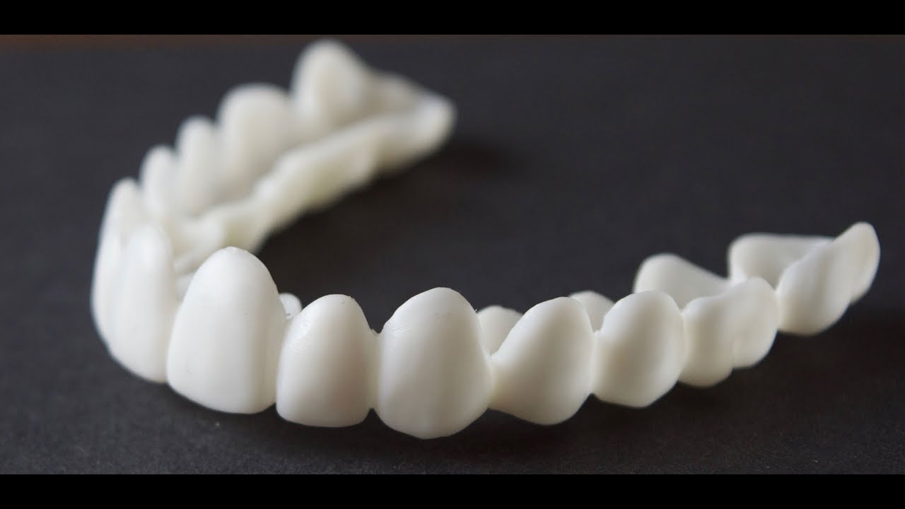 I GOT SOME FREE VENEERS FROM Brighter Image Lab