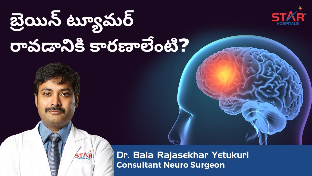 బ్రెయిన్ ట్యూమర్ రావడానికి కారణాలేంటి? Brain Tumor - Latest Treatment in Telugu | Star Hospitals |