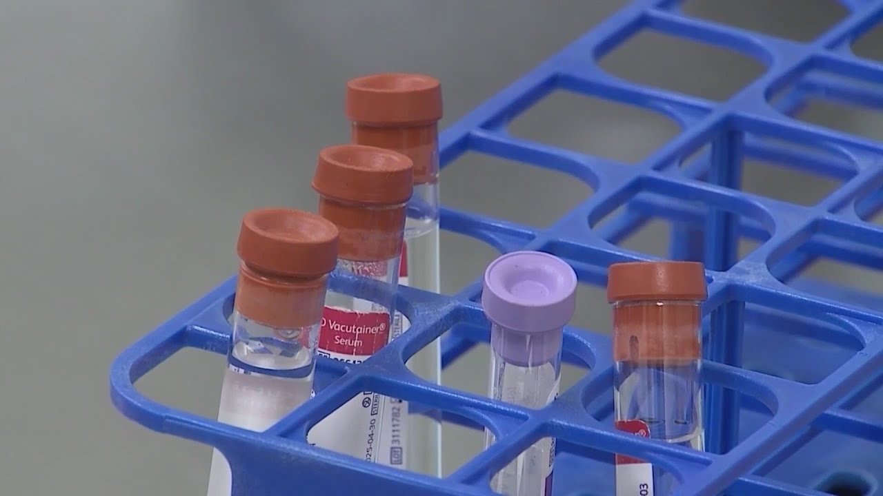 CBI focusing on increasing speed of DNA testing