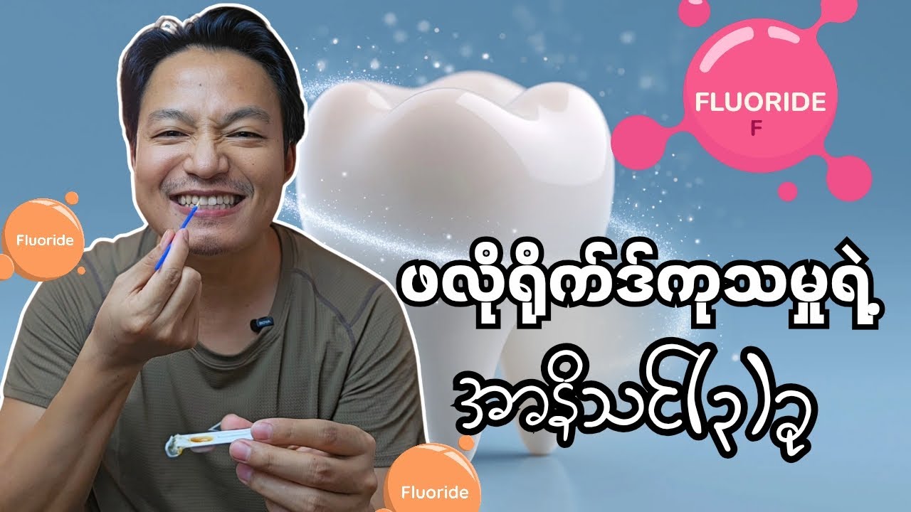 သွားကျဥ်လာလို့ ကိုယ့်သွားနဲ့ကိုယ် ဖလိုရိုက်ဒ်ကုသမှုလေးလုပ်ပါတယ်
