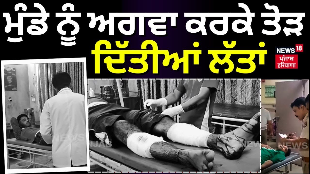 Moga News | ਮੁੰਡੇ ਨੂੰ ਅਗਵਾ ਕਰਕੇ ਤੋੜ ਦਿੱਤੀਆਂ ਲੱਤਾਂ | Latest News | Punjab News | Police | N18V