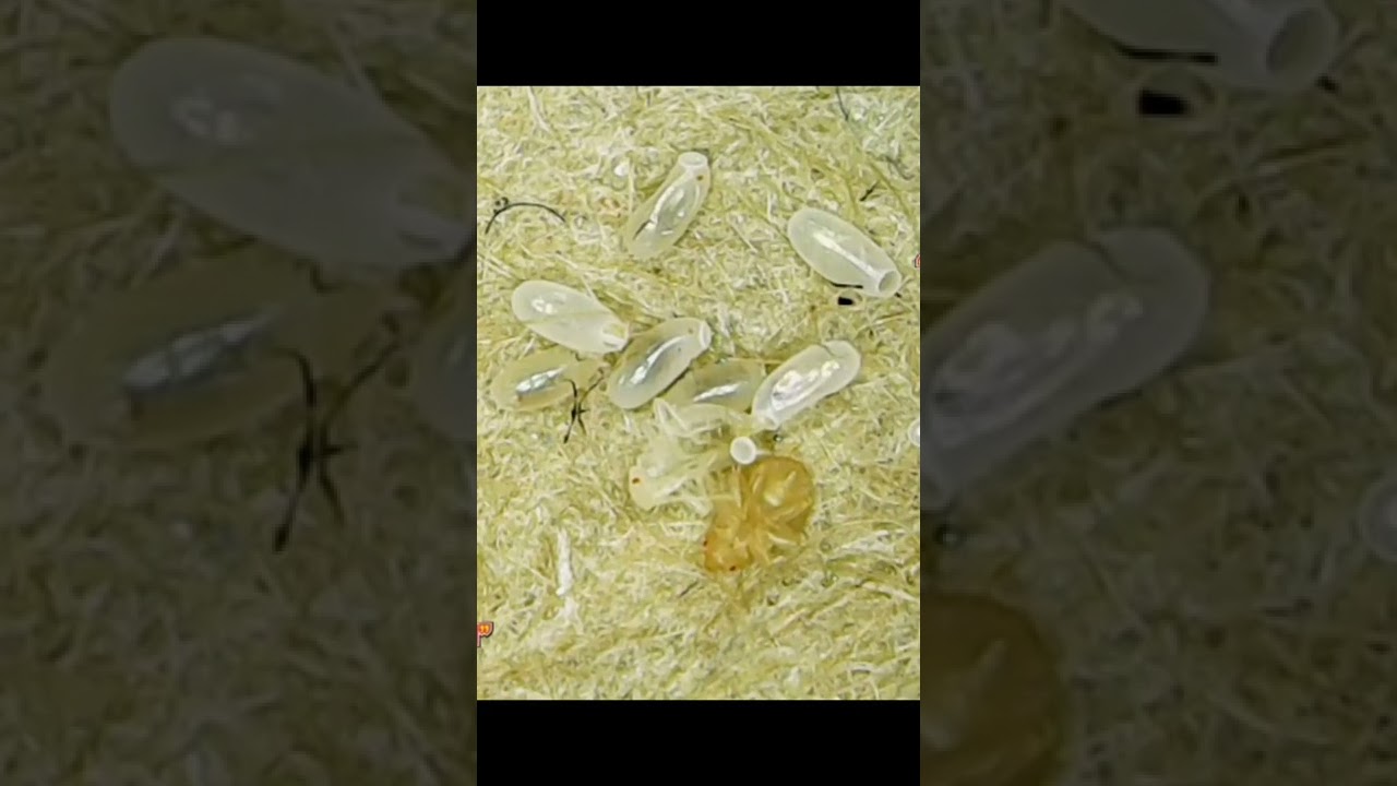 Cimex Lectularius