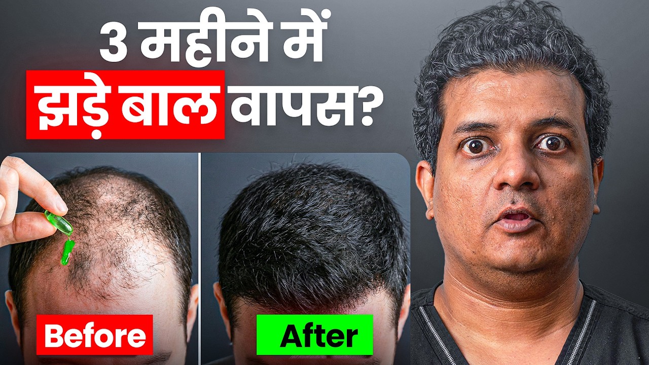 क्या Vitamin E से झड़े हुए बाल वापस आते हैं? Evion 400 कैप्सूल के फायदे