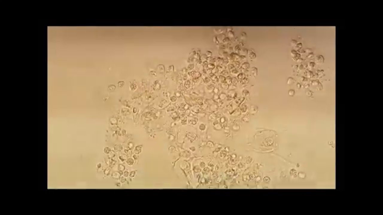 Trichomonas vaginalis