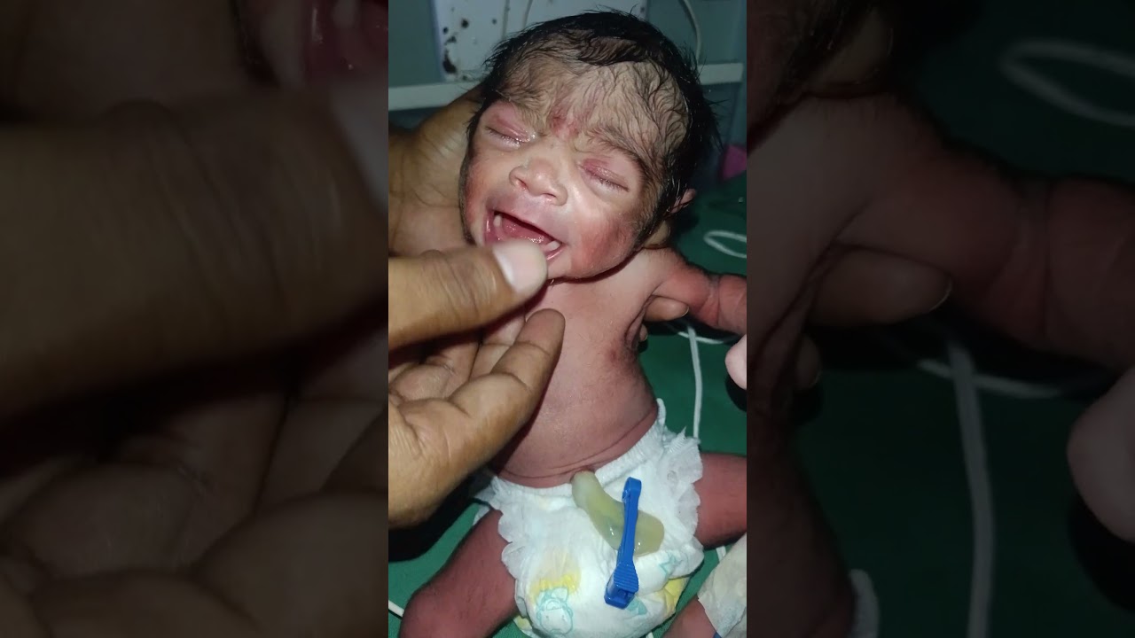 my tiny fighter baby girl #cutebaby #baby #bestfeed #capcut #trustonallah #wittlebaby #goodbaby