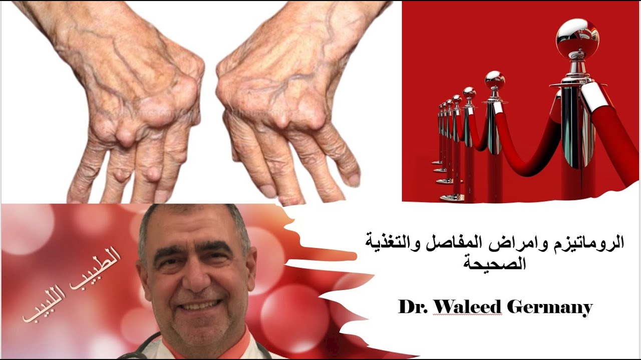 الروماتيزم و التهاب المفاصل المزمن وتأثير الغذاء عليه