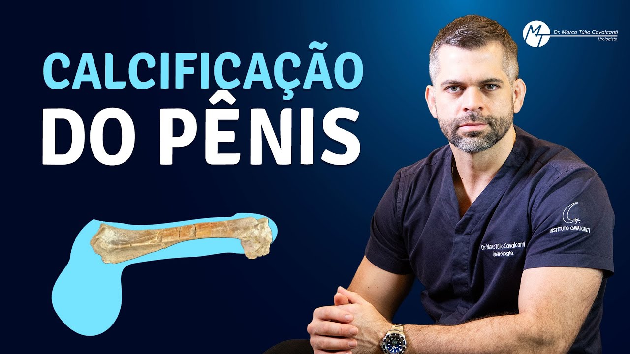 Calcificação do Pênis | Dr. Marco Túlio Cavalcanti
