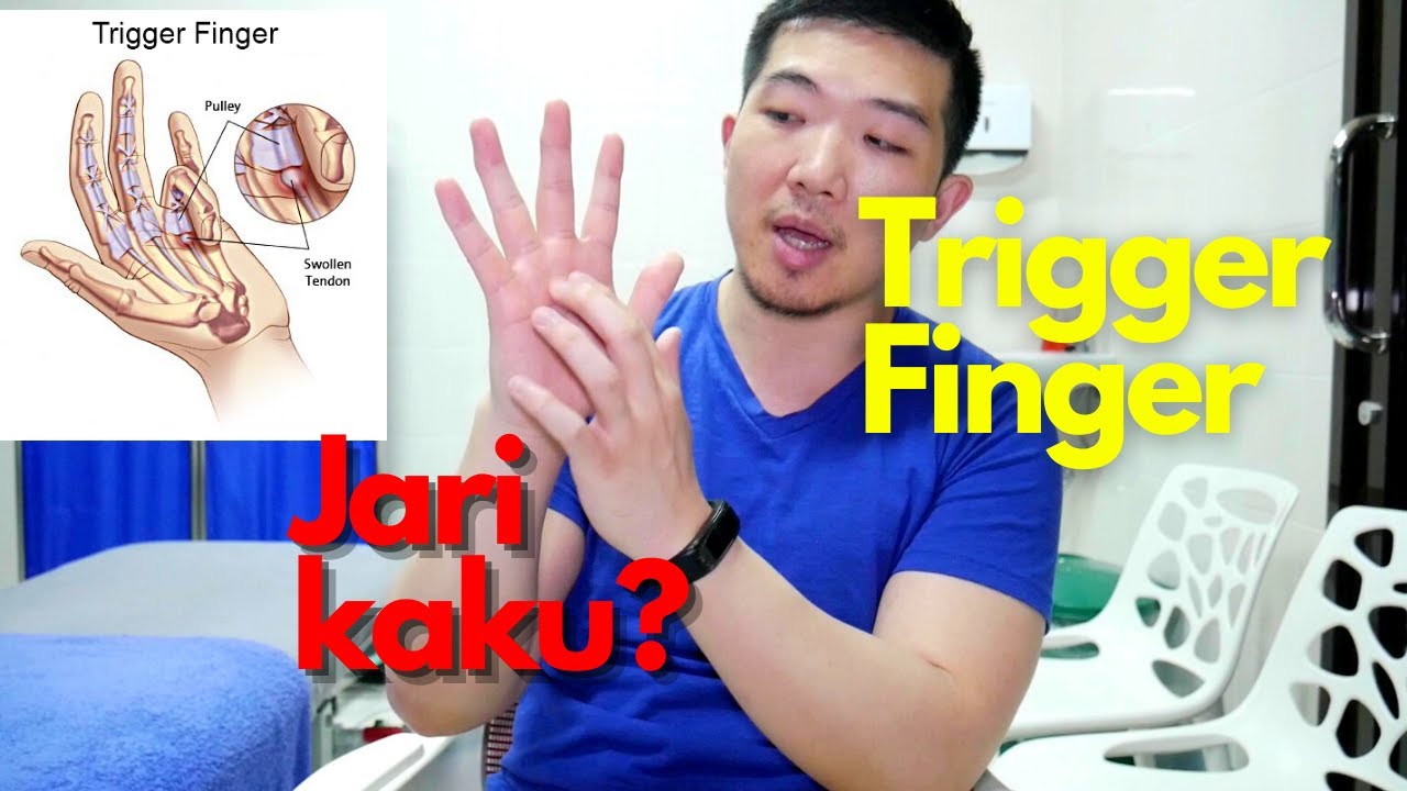 Trigger finger & jari kaku 🖐🏻: Sembuhin sendiri dengan cara mudah!
