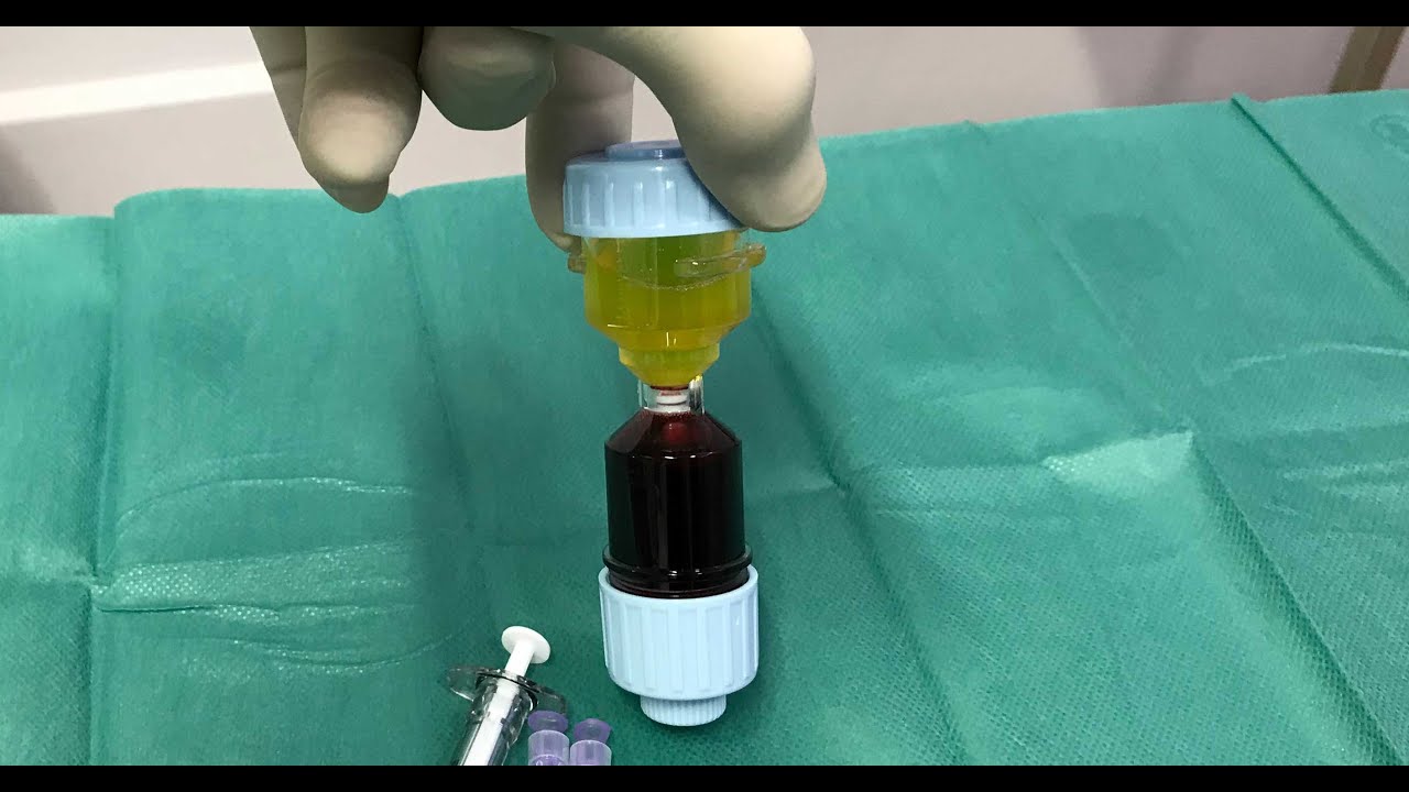 Αυτόλογη Μεσοθεραπεία - PRP ( Platelet Rich Plasma )