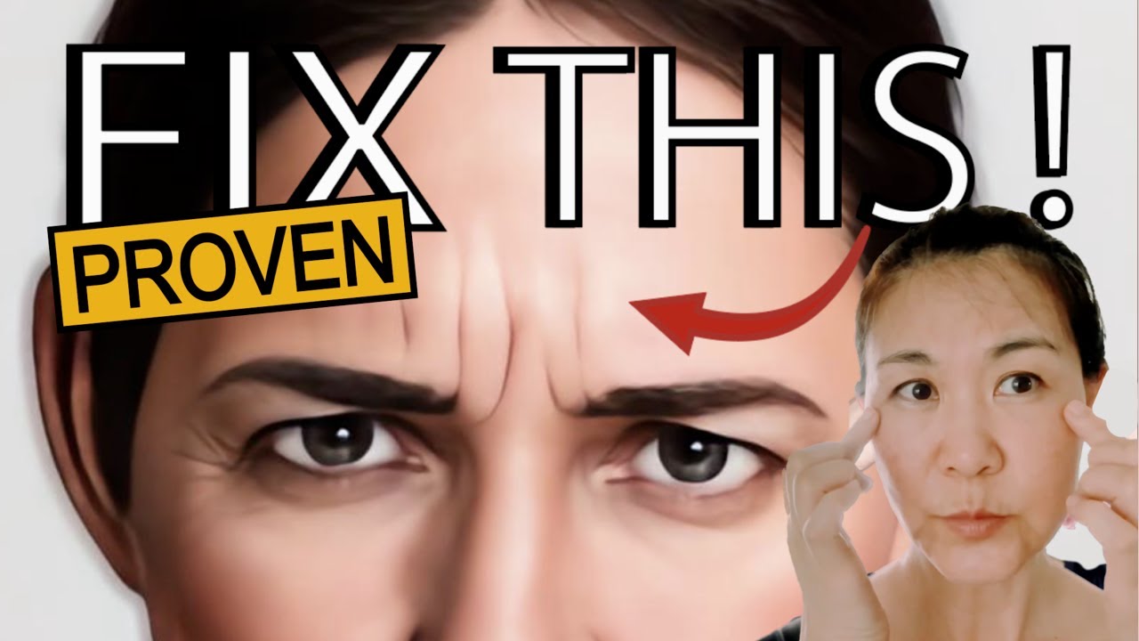 Proven Routine to Remove 11 Lines Without Botox