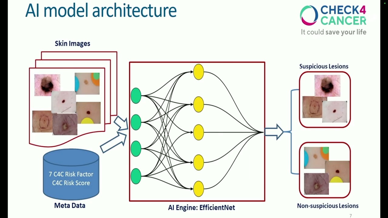 AI for Skin Cancer Detection | MedTech Malta 2024