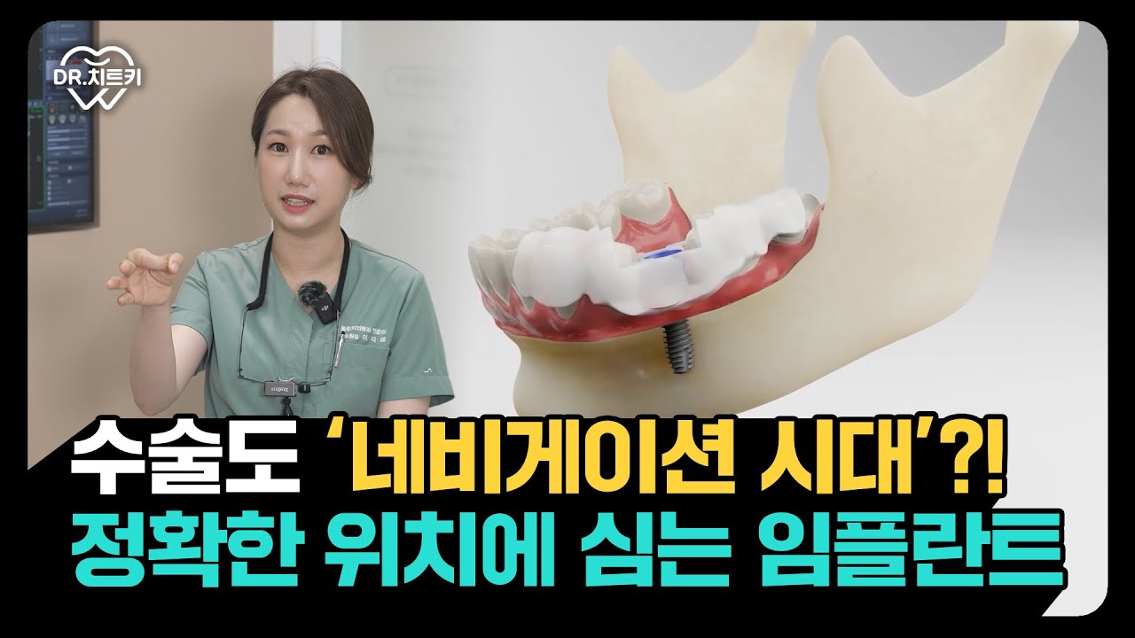 임플란트도 컴퓨터처럼 정확하게? 네비게이션 임플란트의 모든것🦷