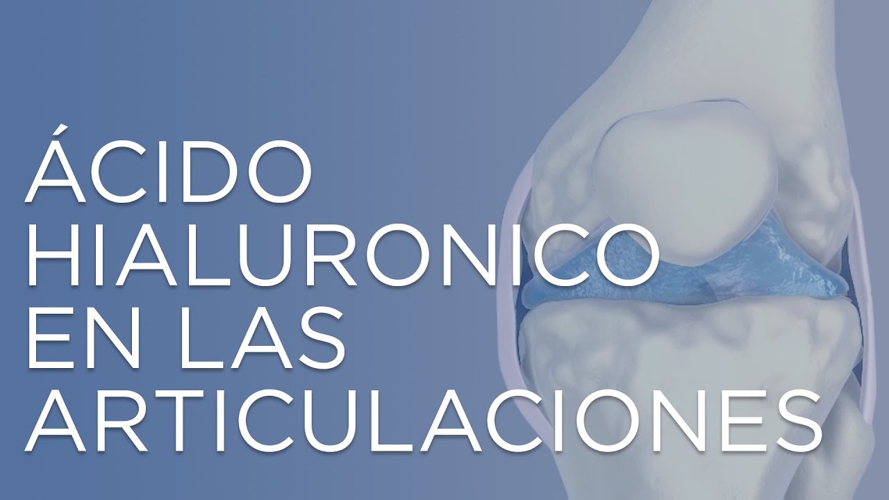 Ácido hialurónico en las articulaciones | IQTRA