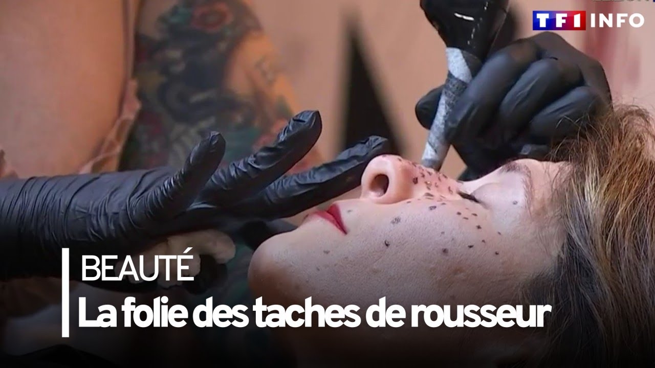 Taches de rousseur : à la mode et lucratives !