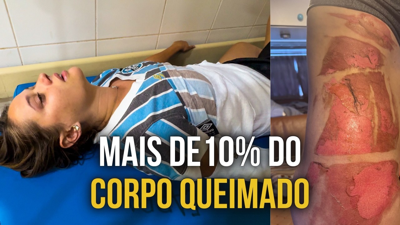 SOFREMOS UM ACIDENTE GRAVE DENTRO DA KOMBI NO PERU