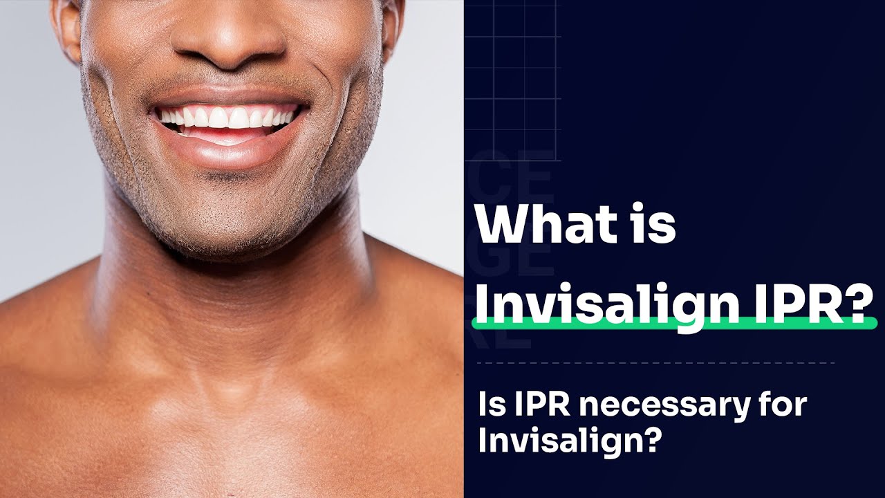 What is Invisalign IPR? Is IPR necessary for Invisalign? | Cosmetic Dentist Preston