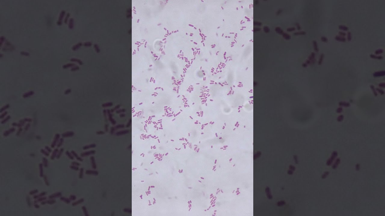 (THE UNBELIEVABLE TRUTH BELOW) This bacteria literally eats antibiotics... 🔬💊 