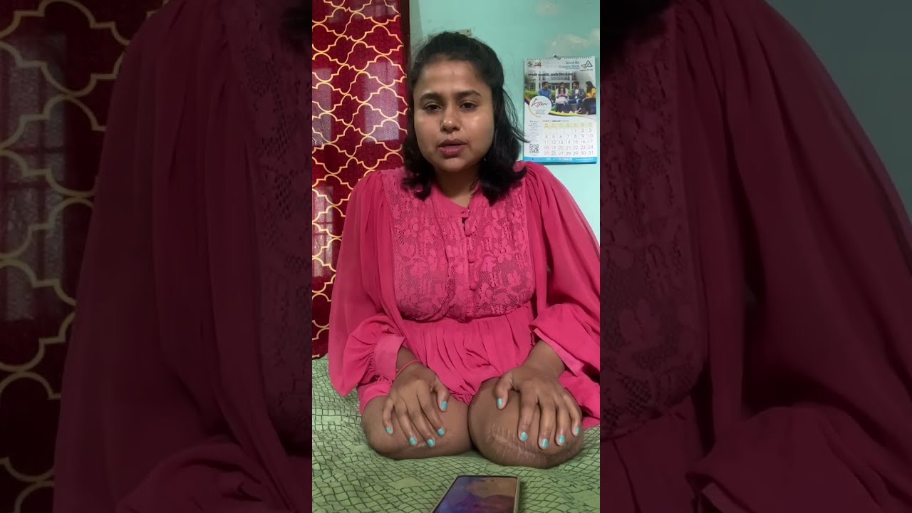 कल मेरे साथ क्या हुआ...😭🧑‍🦽#youtubevideo  #comedy #motivationalspeaking #trending #funny #video 