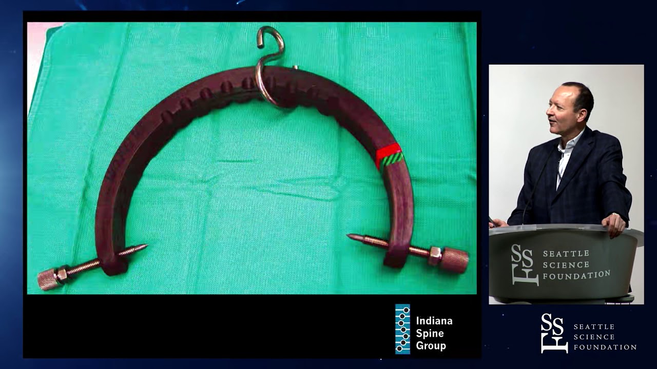 The Dislocated Subaxial C Spine: Reduce First or MRI First - Rick Sasso, MD
