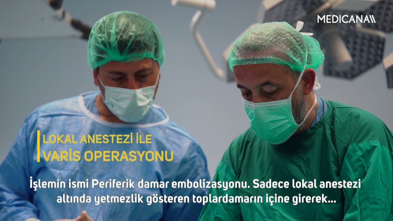 Lokal anestezi ve Cyanoacrilat ile varis ameliyatı