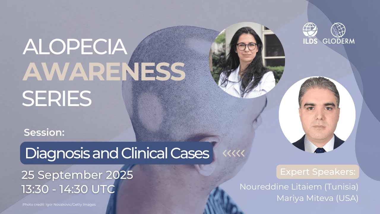 GLODERM Alopecia Awareness Series | Diagnosis and Clinical Cases
