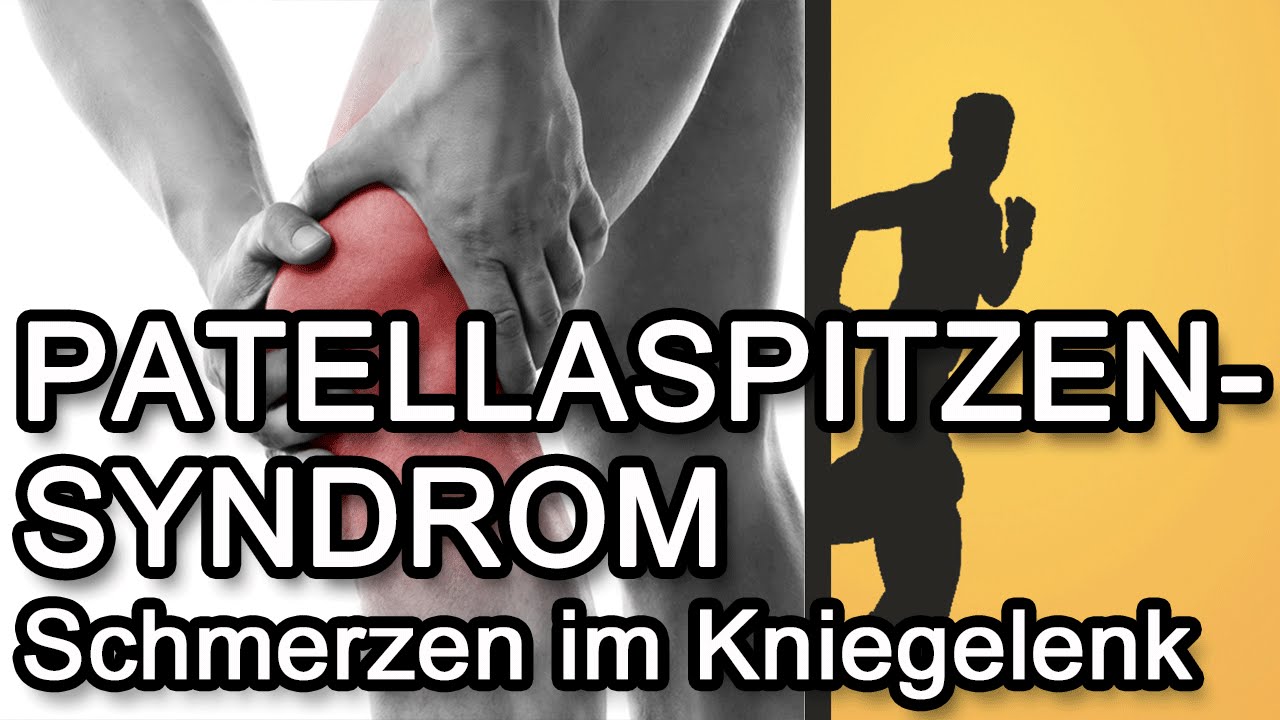 Patellaspitzensyndrom / Jumper`s Knee - Ursachen & Symptome (Teil 1)