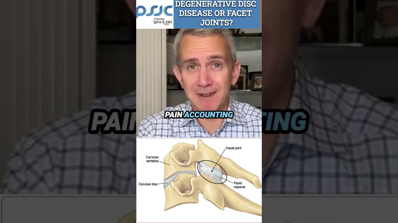 Facet Joints vs. Discs: The REAL Cause of Your Pain