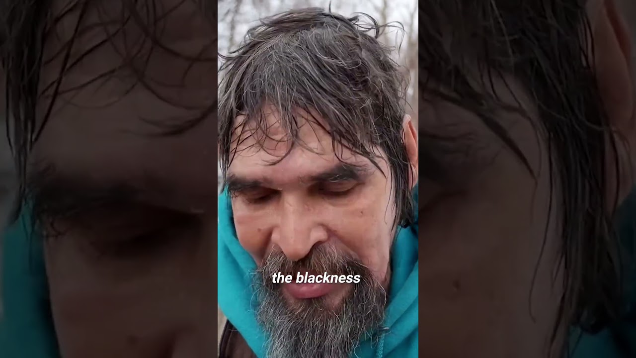 Бездомный с обмороженной рукой. Он спит на улице в холоде.