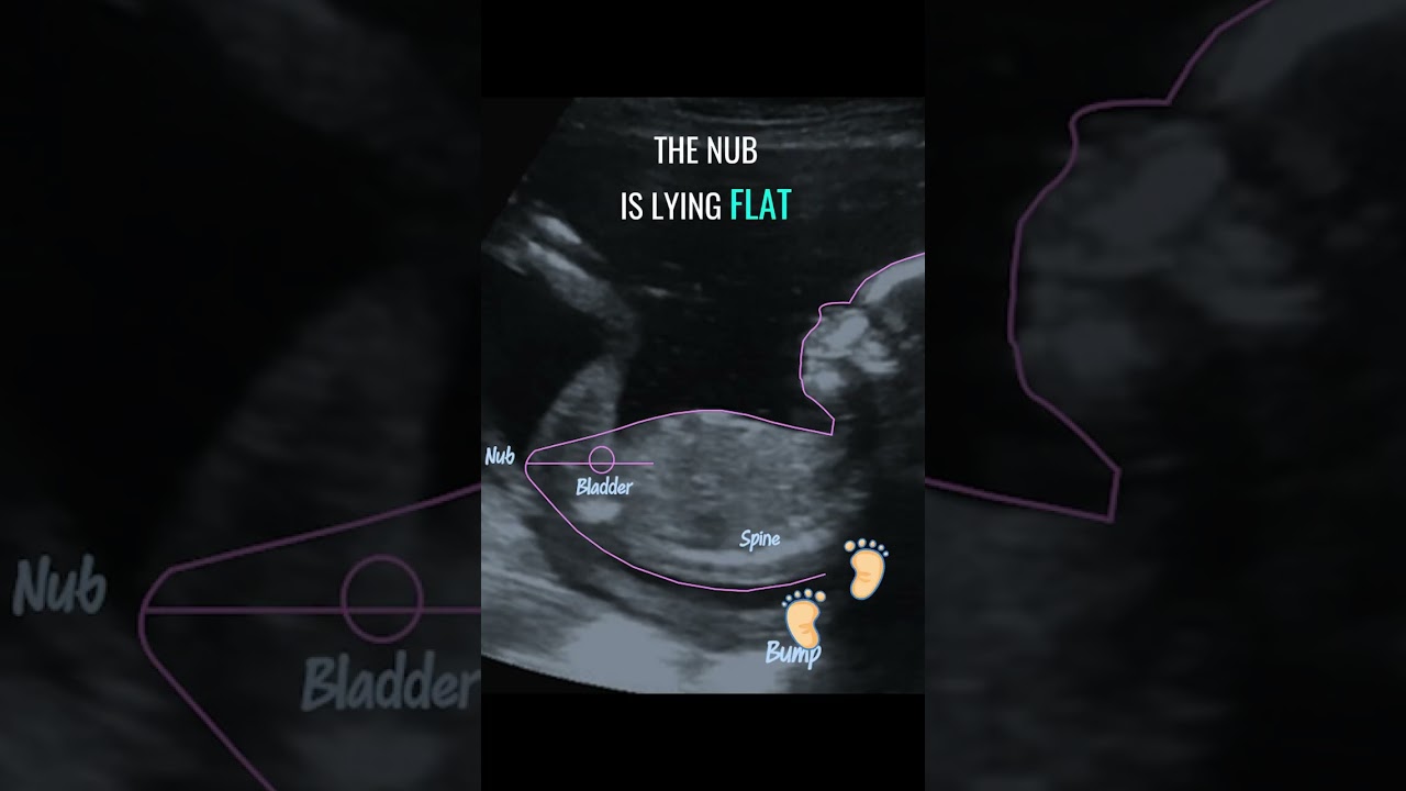 Gender reveal with NubX!