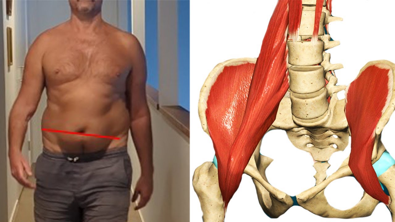 One-Sided Psoas Pain & Pelvis tilt SOLUTION (2 exercises to fix Left AIC pattern)