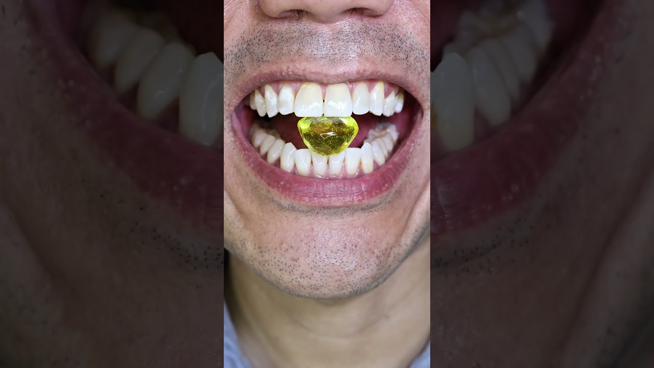 ASMR | Yellow Diamond Hard Candy 💎🍋 