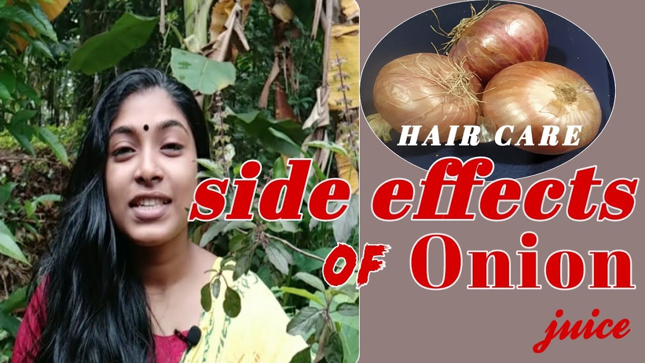 Side effect of onion juice ഉള്ളിയുടെ നീര് ഉപയോഗിക്കാറുണ്ടോ?..