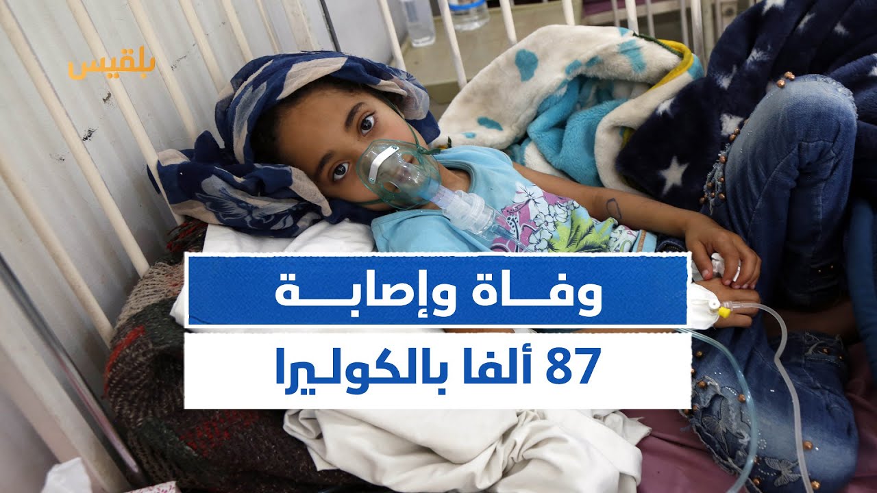 الكوليرا تحصد أرواح اليمنيين..وفاة وإصابة أكثر من 87 ألفا بالكوليرا منذ مطلع العام