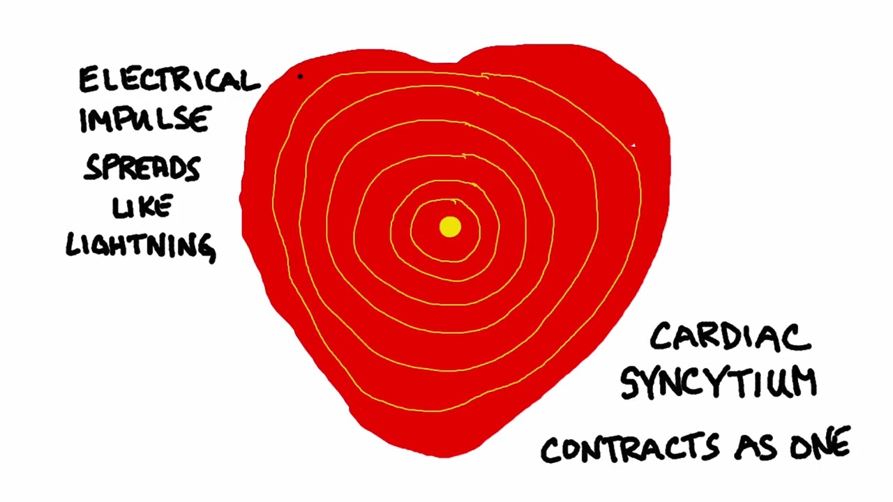 Ventricular Tachycardia/Syncope