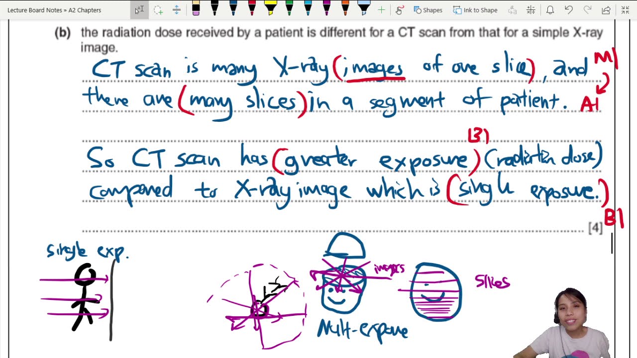 24.2a Ex1 ON14 P41 Q11 CT vs X-Ray Radiation Exposure | A2 Medical Physics | CAIE A Level Physics