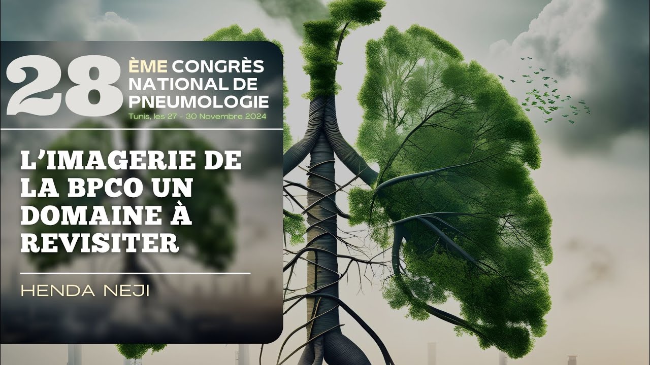 L’imagerie de la BPCO un domaine à revisiter. Henda Neji