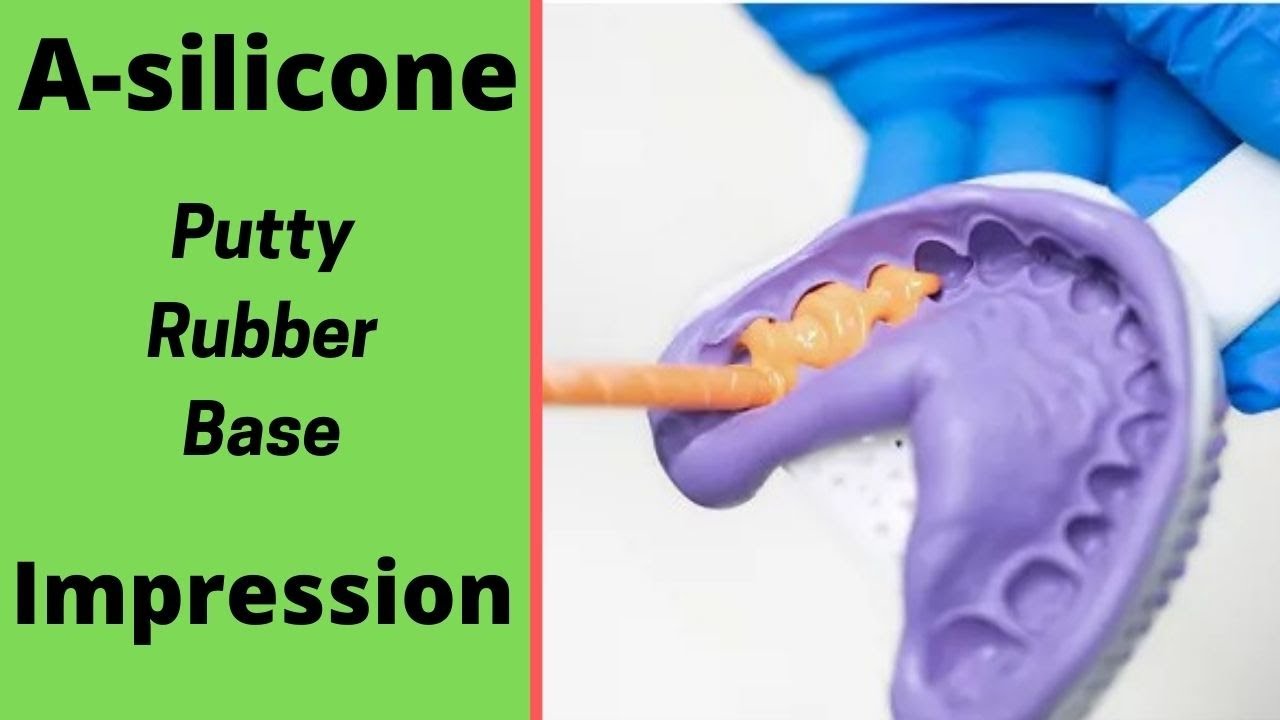 Easy Impression Technique - A SIlicone || GC Flexceed Putty & Light Body Impression.