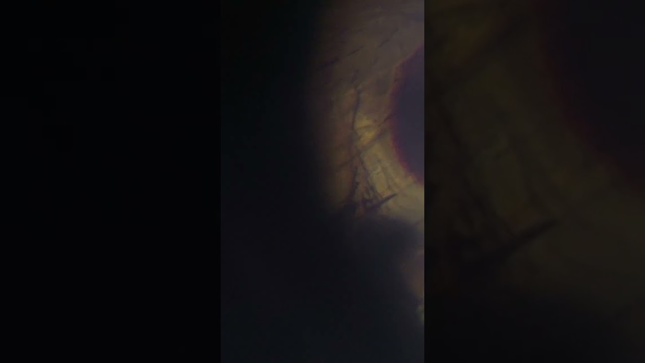 Inside a banana fly