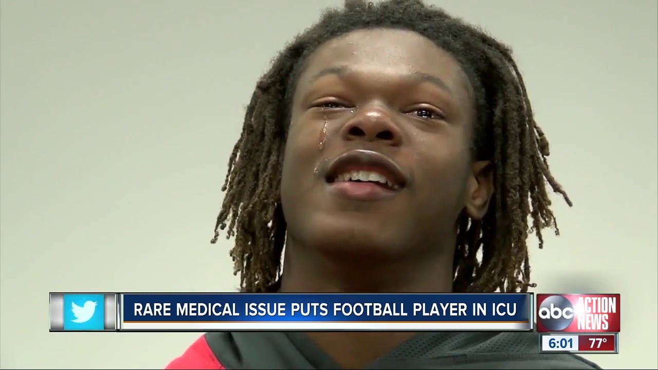 Family, friends praying for Northeast High football player in ICU from brain condition