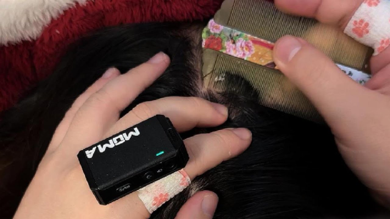 ASMR Tranquil Dandruff Hunt and Clean with Comb & Nails – No Talking